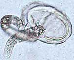 Ascaris lumbricoides larva hatching from an egg