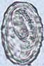 Ascaris lumbricoides larva inside an egg