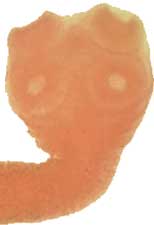 Taenia saginata scolex (head)